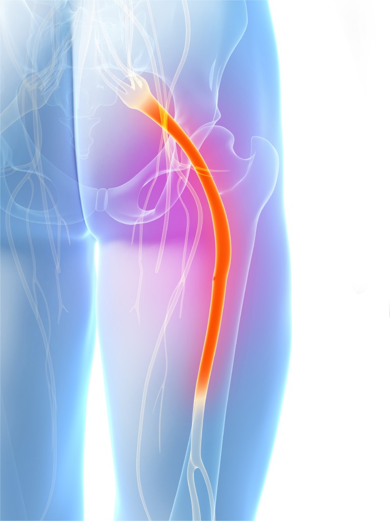 Pain In The Backside Dealing With Sciatic Nerve Pain Chiropractor Houston Texas Harper
