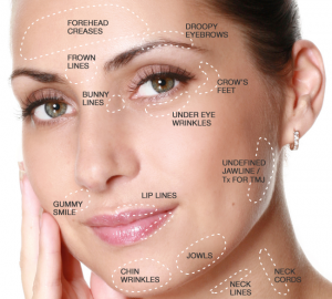 cosmetic injection sites